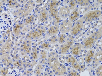 GGT1 Antibody