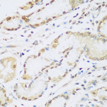 Cyclin D2 Antibody