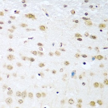Cyclin D2 Antibody