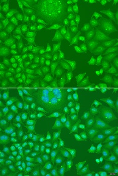 Cyclin D2 Antibody
