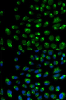 IFNAR2 Antibody