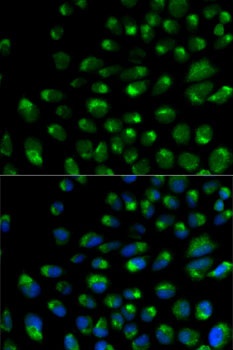 IFNAR2 Antibody