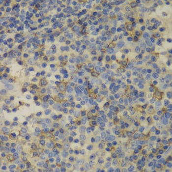 FTL Antibody