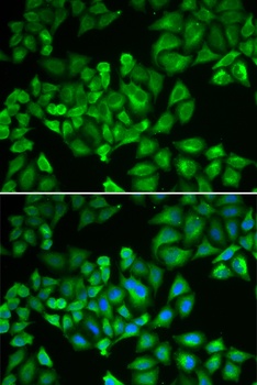 FTL Antibody
