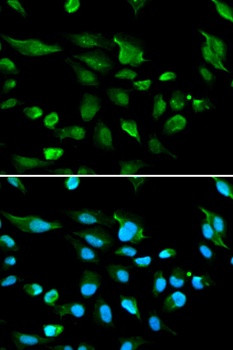AIRE Antibody
