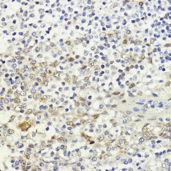 LDB1 Antibody