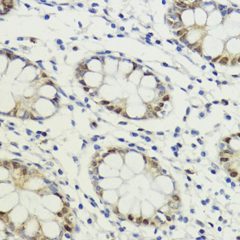 LDB1 Antibody