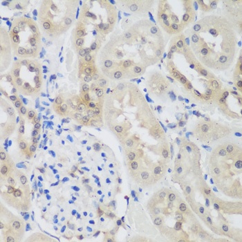UBE3A Antibody