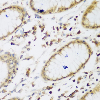 UBE3A Antibody