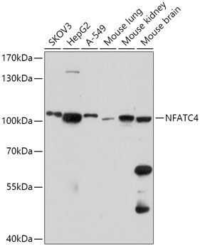 NFATC4 Antibody