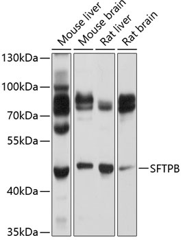 SFTPB Antibody