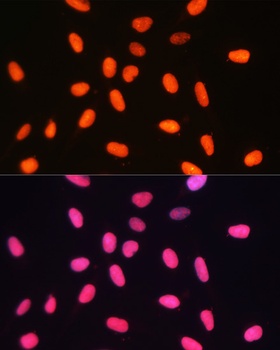 DNMT1 Antibody