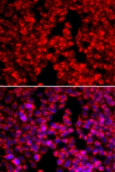 MTTP Antibody
