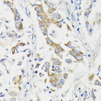 PDHA1 Antibody