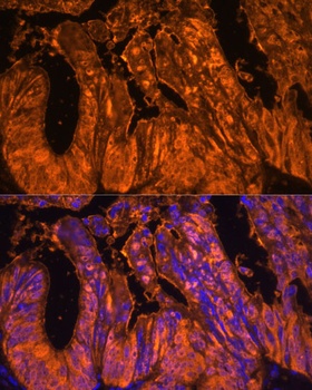 LGALS4 Antibody