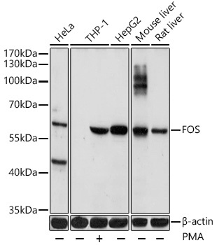 FOS Antibody