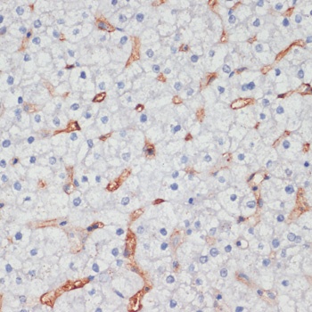 CD36 Antibody