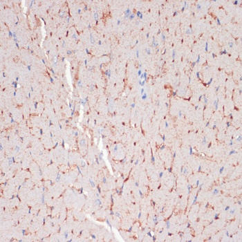 CD36 Antibody