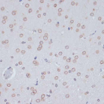 CD36 Antibody