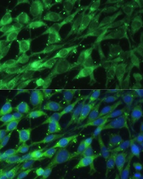 LMNA Antibody