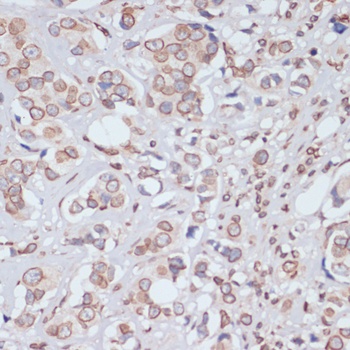 LMNA Antibody