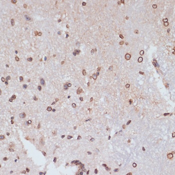 LMNA Antibody