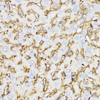 YKL-40 / CHI3L1 Antibody