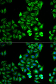 DRD5 Antibody