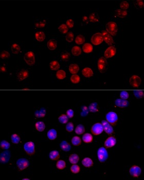 CYP27B1 Antibody