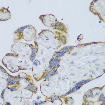 CYP11A1 Antibody