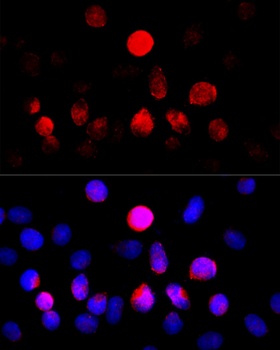 CYP11A1 Antibody