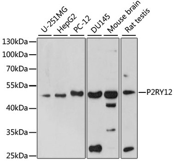 P2RY12 Antibody