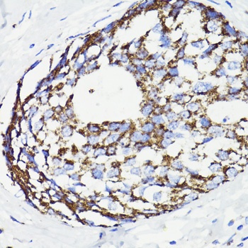 PDCD10 Antibody