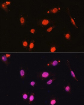 DDX17 Antibody
