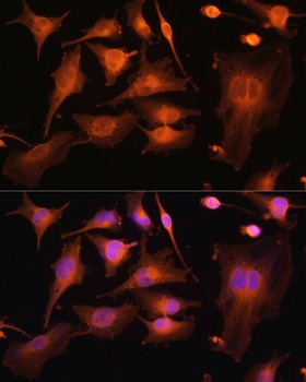 TUBB3 Antibody