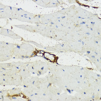 Complement Factor B Antibody