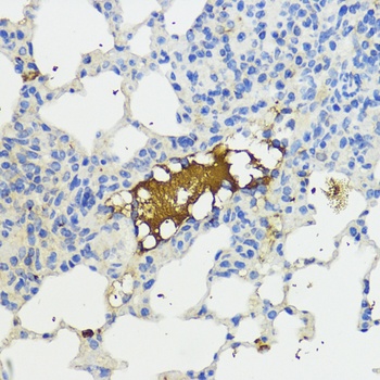Complement Factor B Antibody