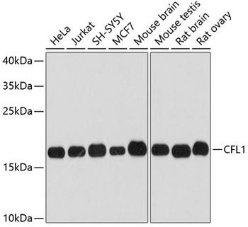 CFL1 Antibody