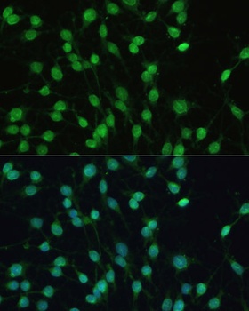 NR1I2 Antibody