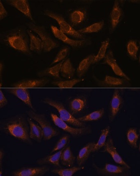 SOCS2 Antibody