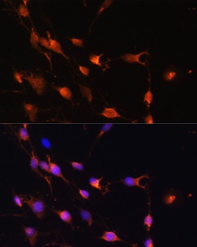 RAB11A Antibody