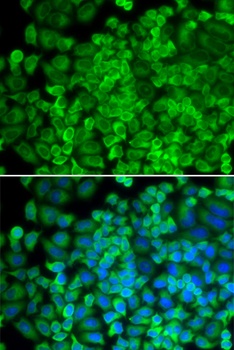 GLA Antibody