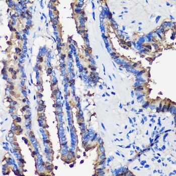 SCGB1A1 Antibody