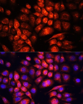 UCP3 Antibody