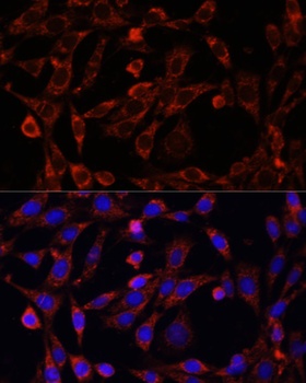 UCP3 Antibody