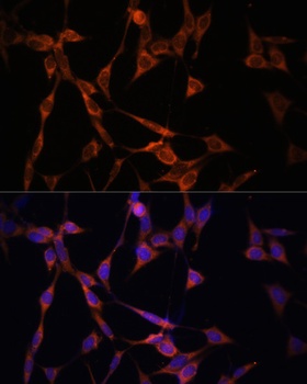 TGFBR1 Antibody