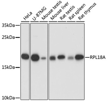 RPL18A Antibody