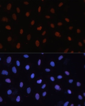 RB1 Antibody