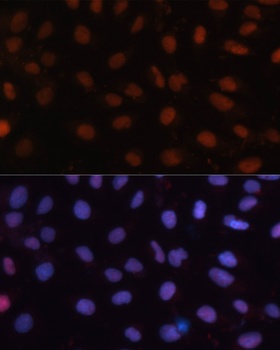 RB1 Antibody