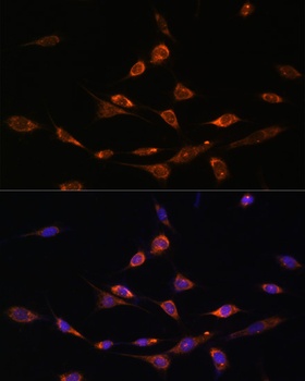 PAK3 Antibody